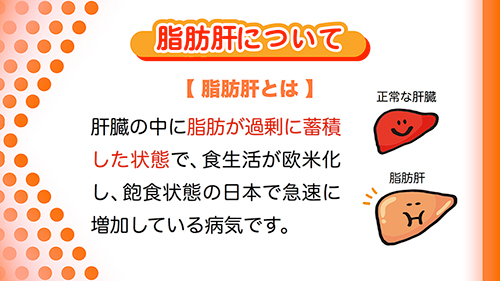 脂肪肝について|脂肪肝とは、肝臓の中に脂肪が過剰に蓄積した状態で、食生活が欧米化し、飽食状態の日本で急速に増加している病気です。