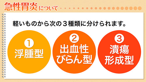 急性胃炎について|浮腫型・出血性びらん型・潰瘍形成型