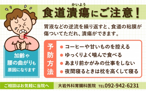 食道潰瘍にご注意