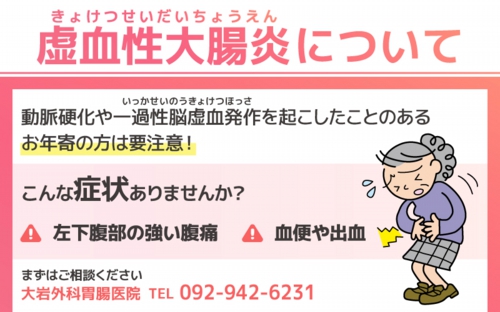 虚血性大腸炎について