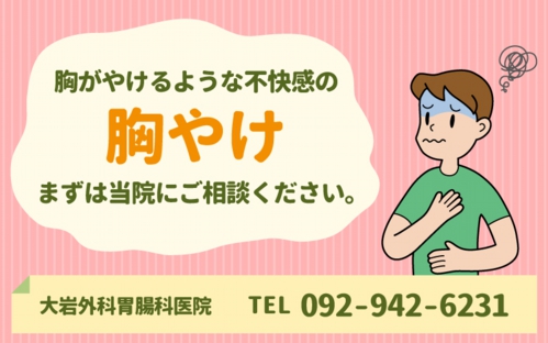 胸やけについて