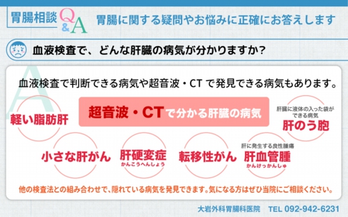 血液検査や超音波・CTでわかる肝臓の病気