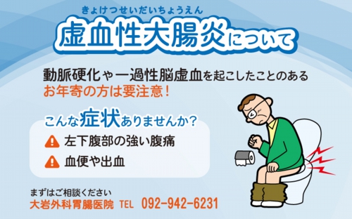 虚血性大腸炎について