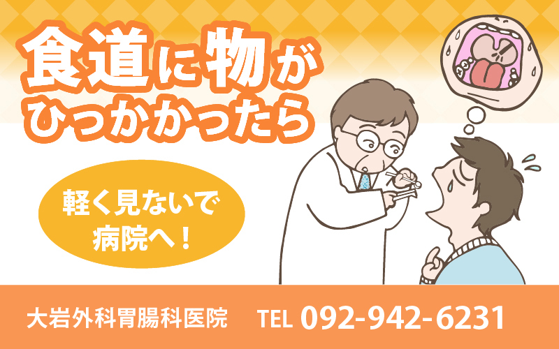 食道に物がひっかかったら…