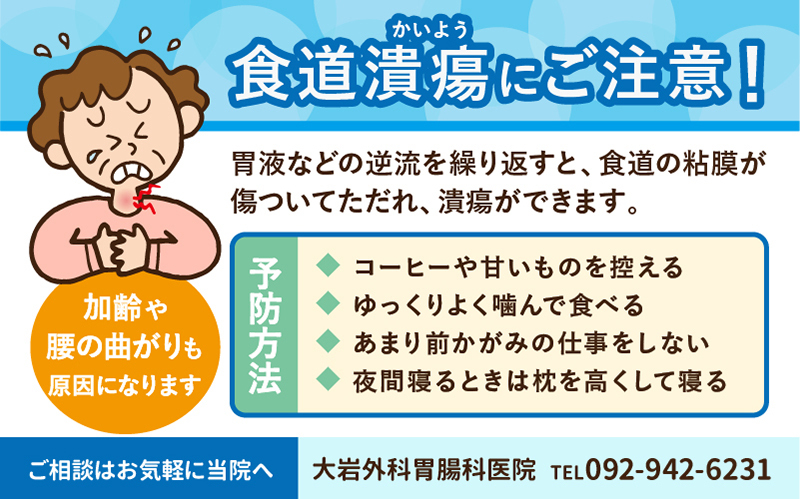 食道潰瘍にご注意