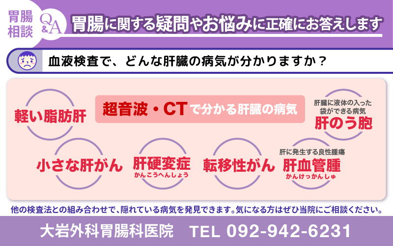 血液検査や超音波・CTでわかる肝臓の病気