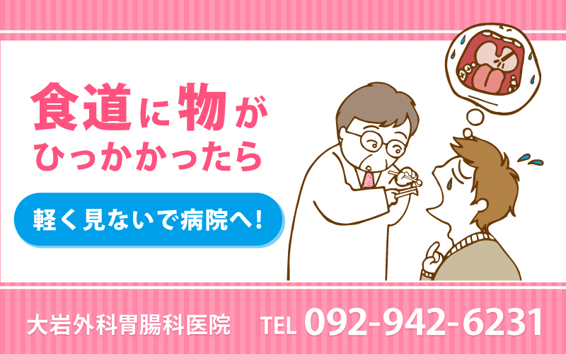 食道に物がひっかかったら…