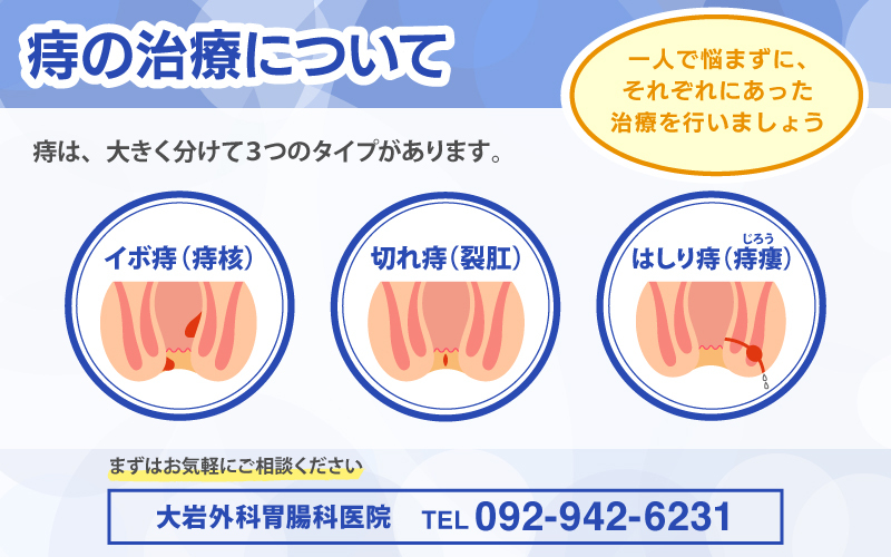 痔の治療について