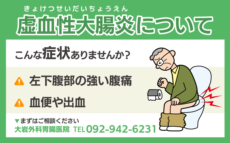 虚血性大腸炎について