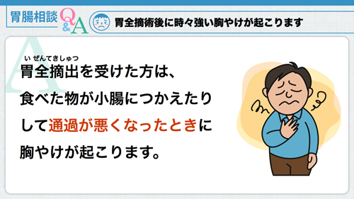 胃腸相談|胃全摘手術後の胸やけについて
