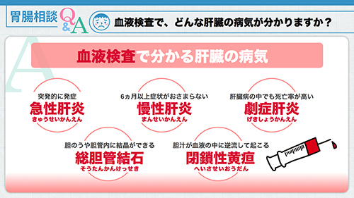 肝機能・肝臓の病気について|血液検査でわかる肝臓の病気