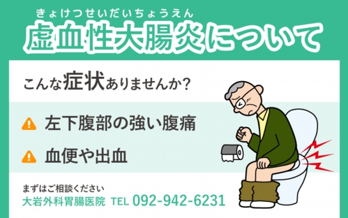 虚血性大腸炎について