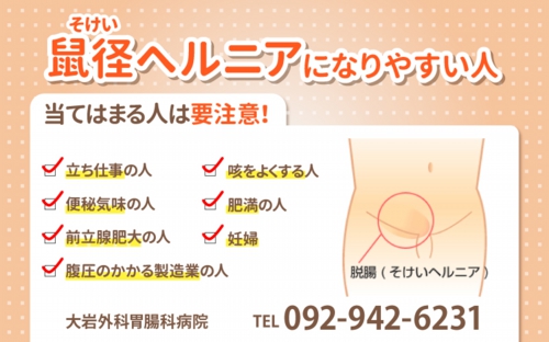 鼠径ヘルニアになりやすい人