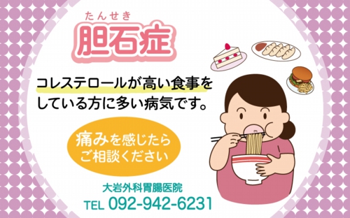 胆石症について