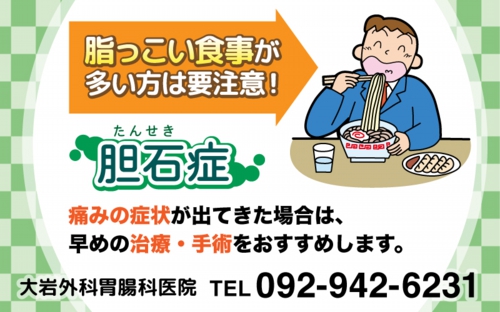 胆石症について