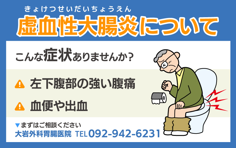 虚血性大腸炎について