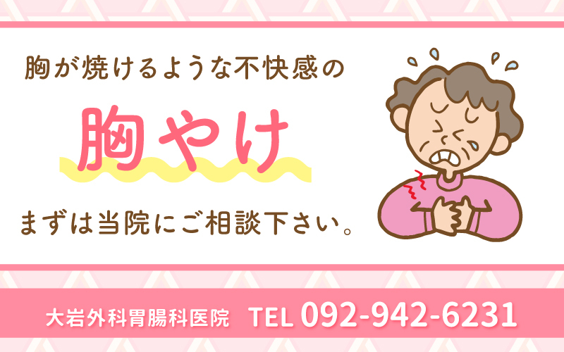 胸やけについて