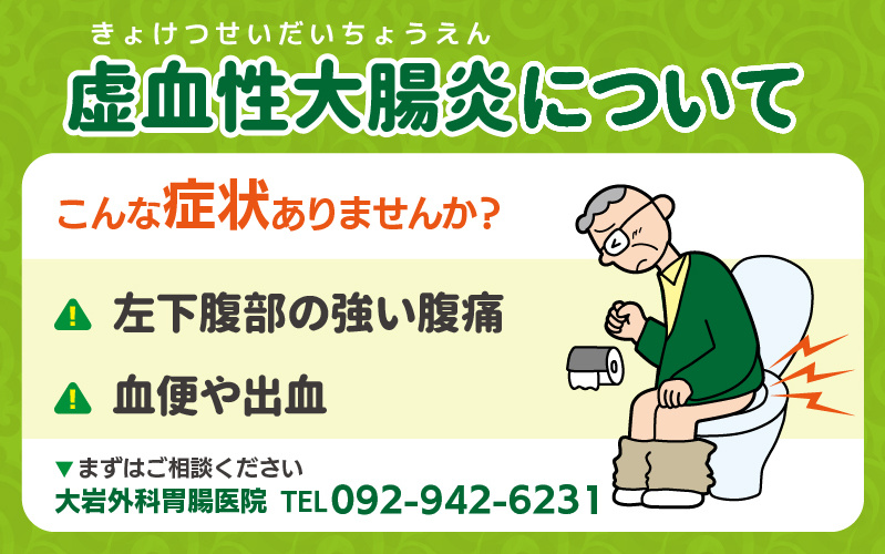 虚血性大腸炎について