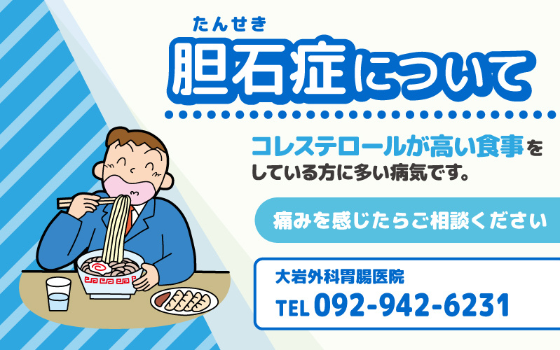胆石症について