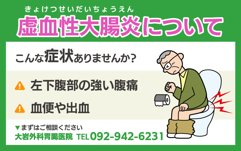虚血性大腸炎について